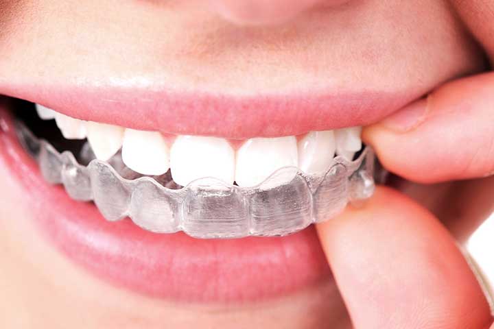 Philadelphia and Langhorne PA Orthodontist - Types of Braces We Offer